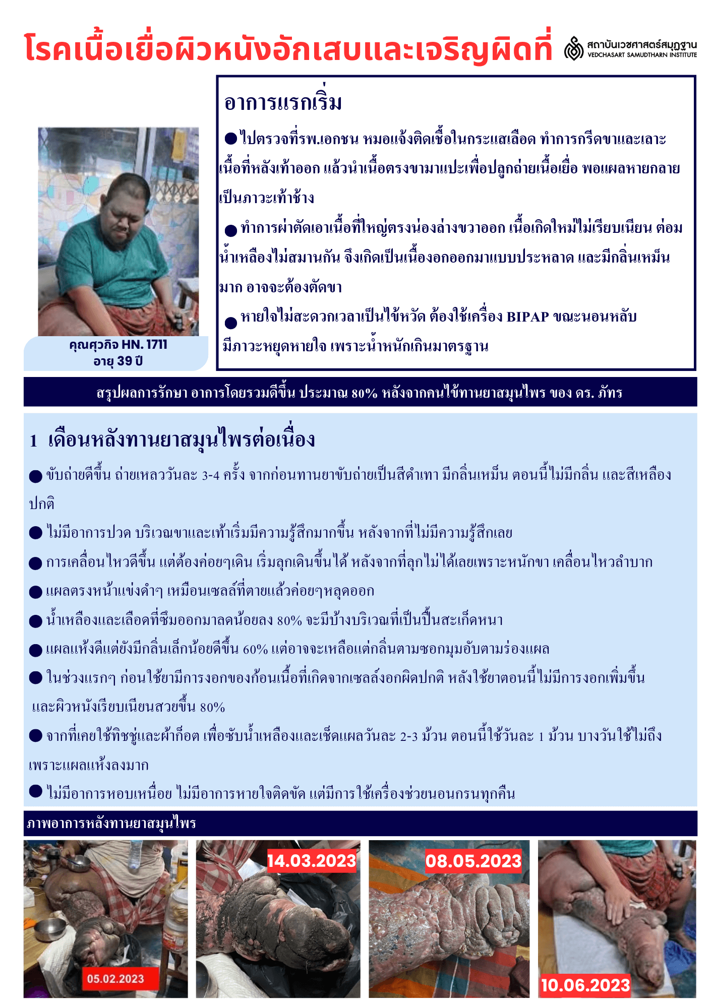 ศูนย์มะเร็ง ดร.ภัทร์ - DR.Part Cancer Center