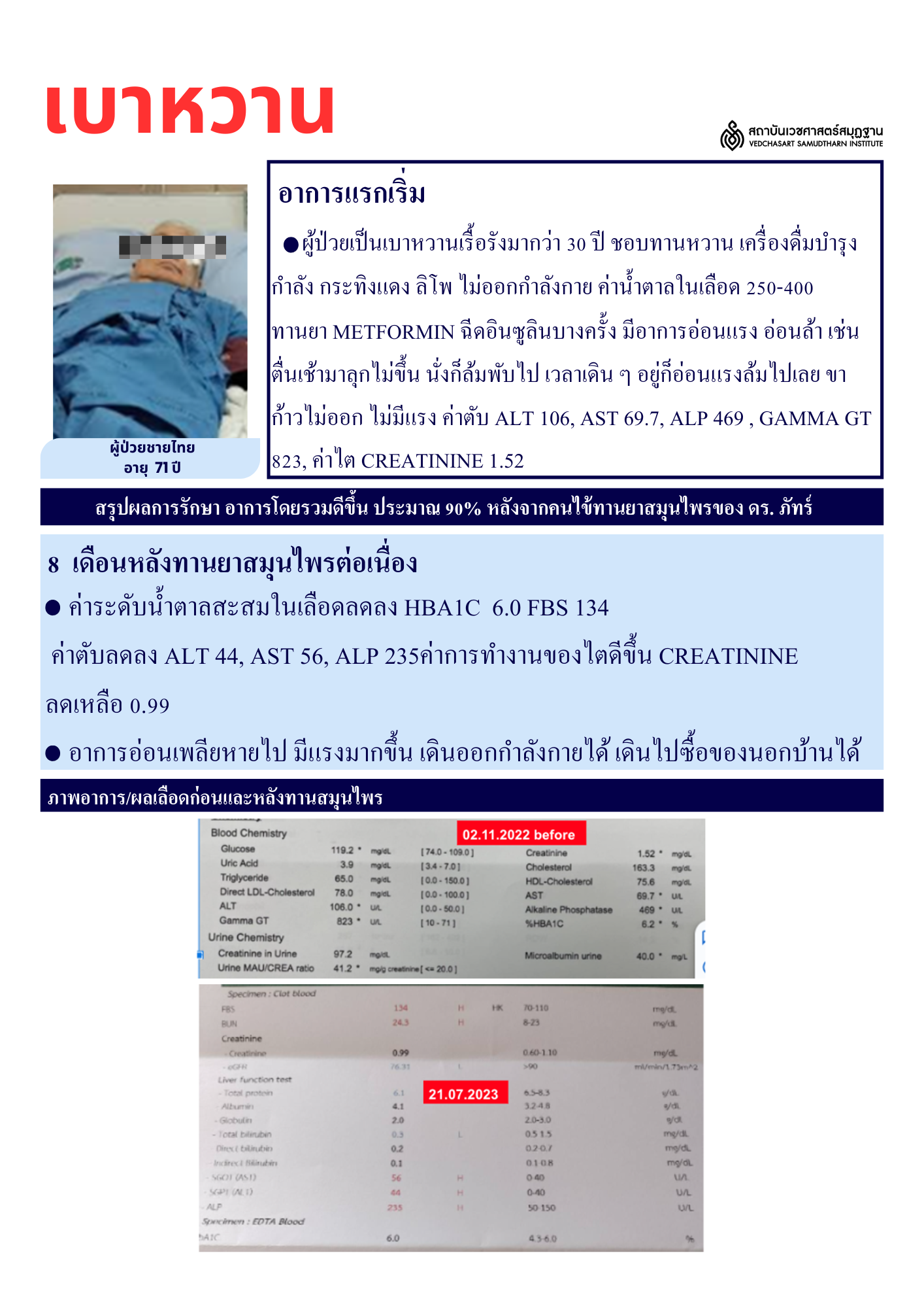 โรคเบาหวาน Diabetes