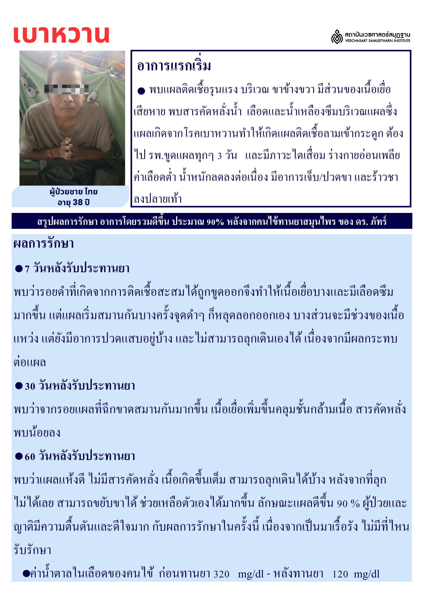 โรคเบาหวาน Diabetes
