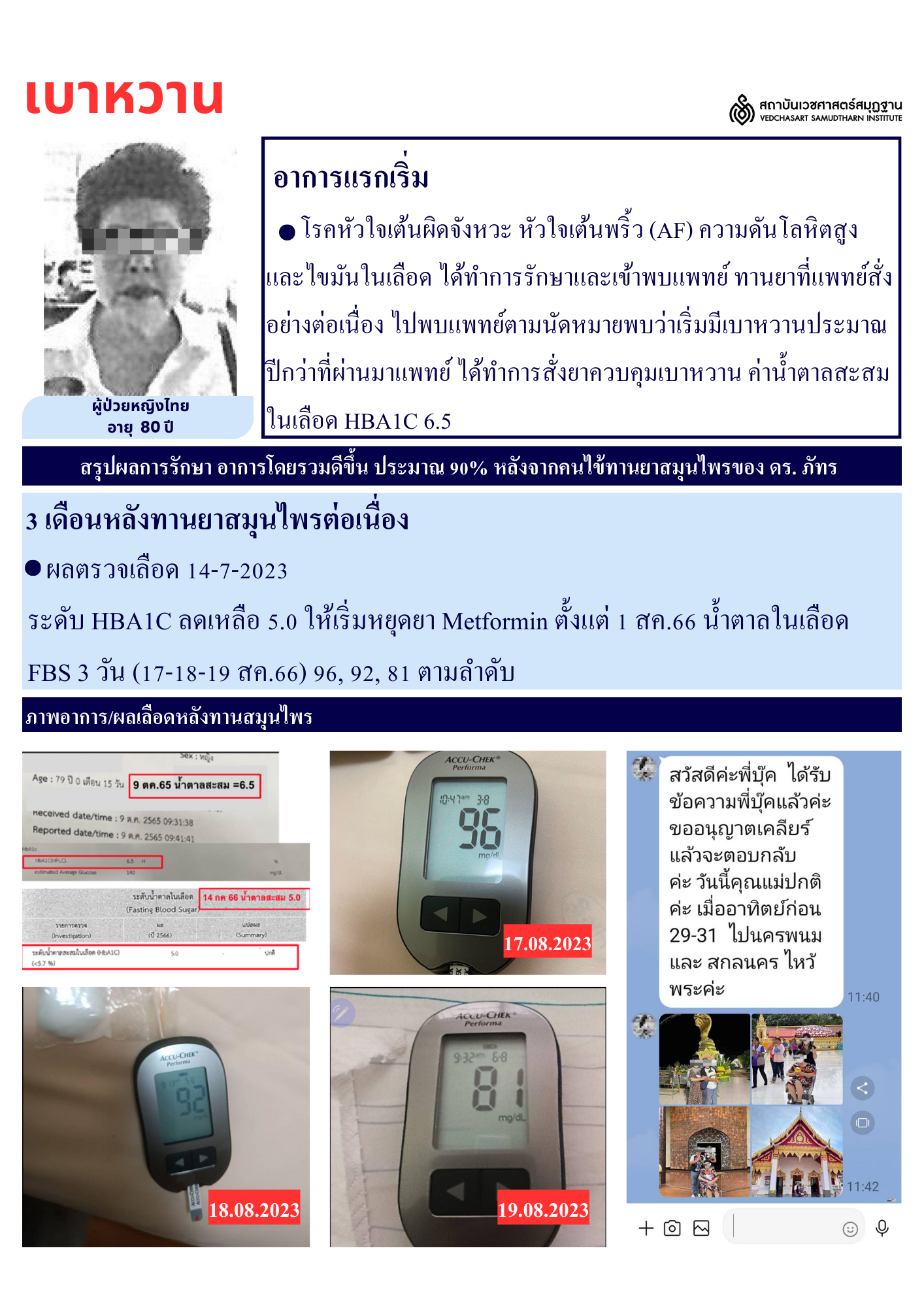โรคเบาหวาน Diabetes