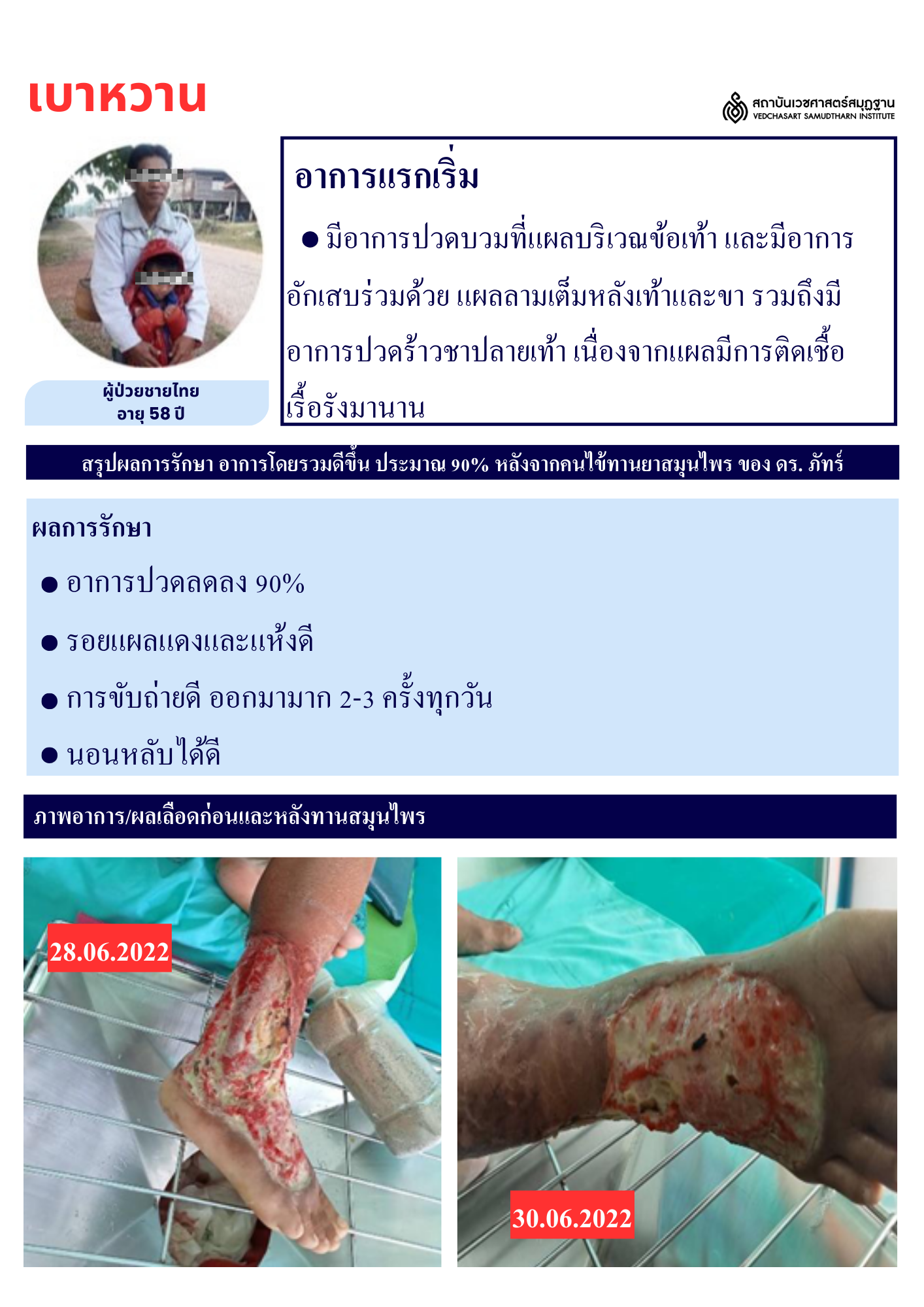 โรคเบาหวาน Diabetes