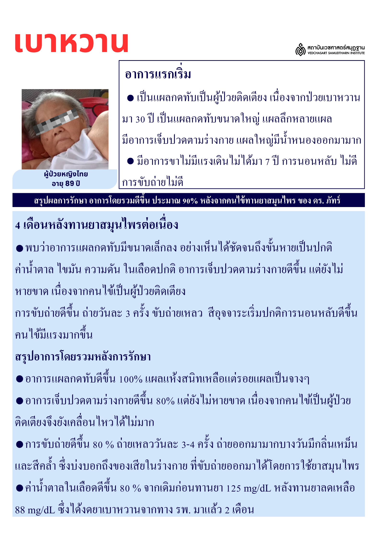 โรคเบาหวาน Diabetes