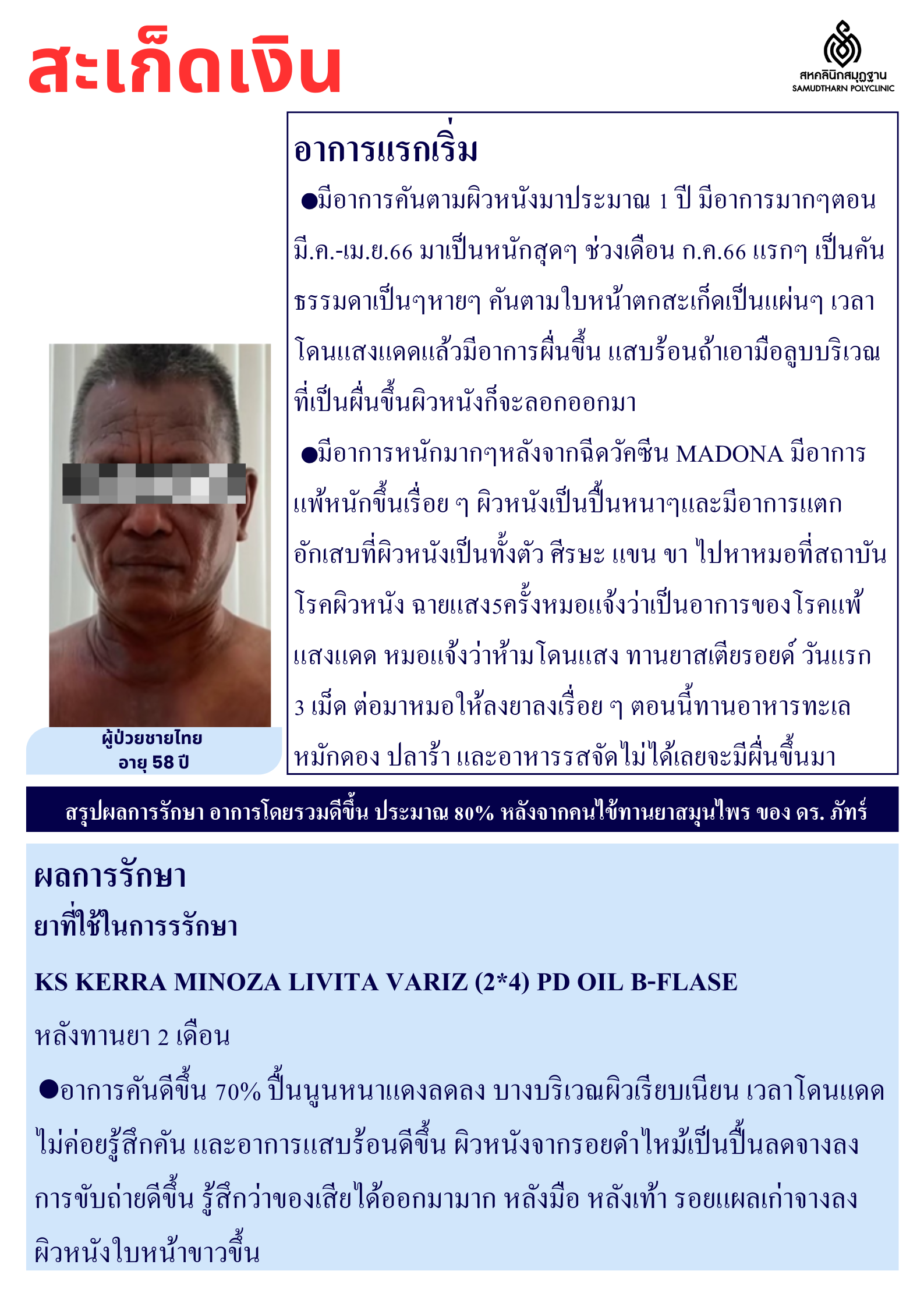 โรคผิวหนัง Skin Disease