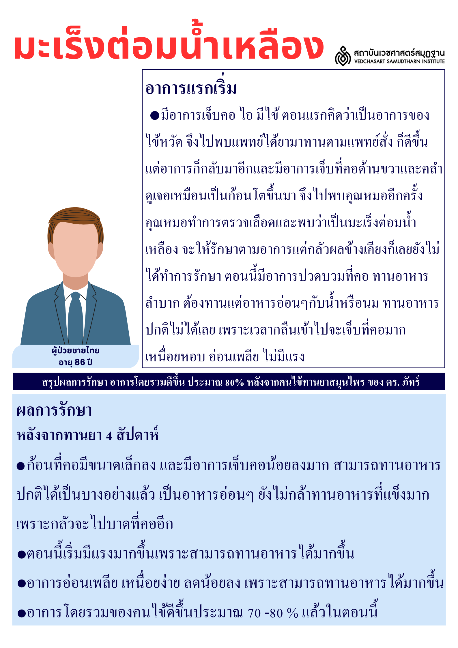 โรคมะเร็งต่อมน้ำเหลือง Lymphoma