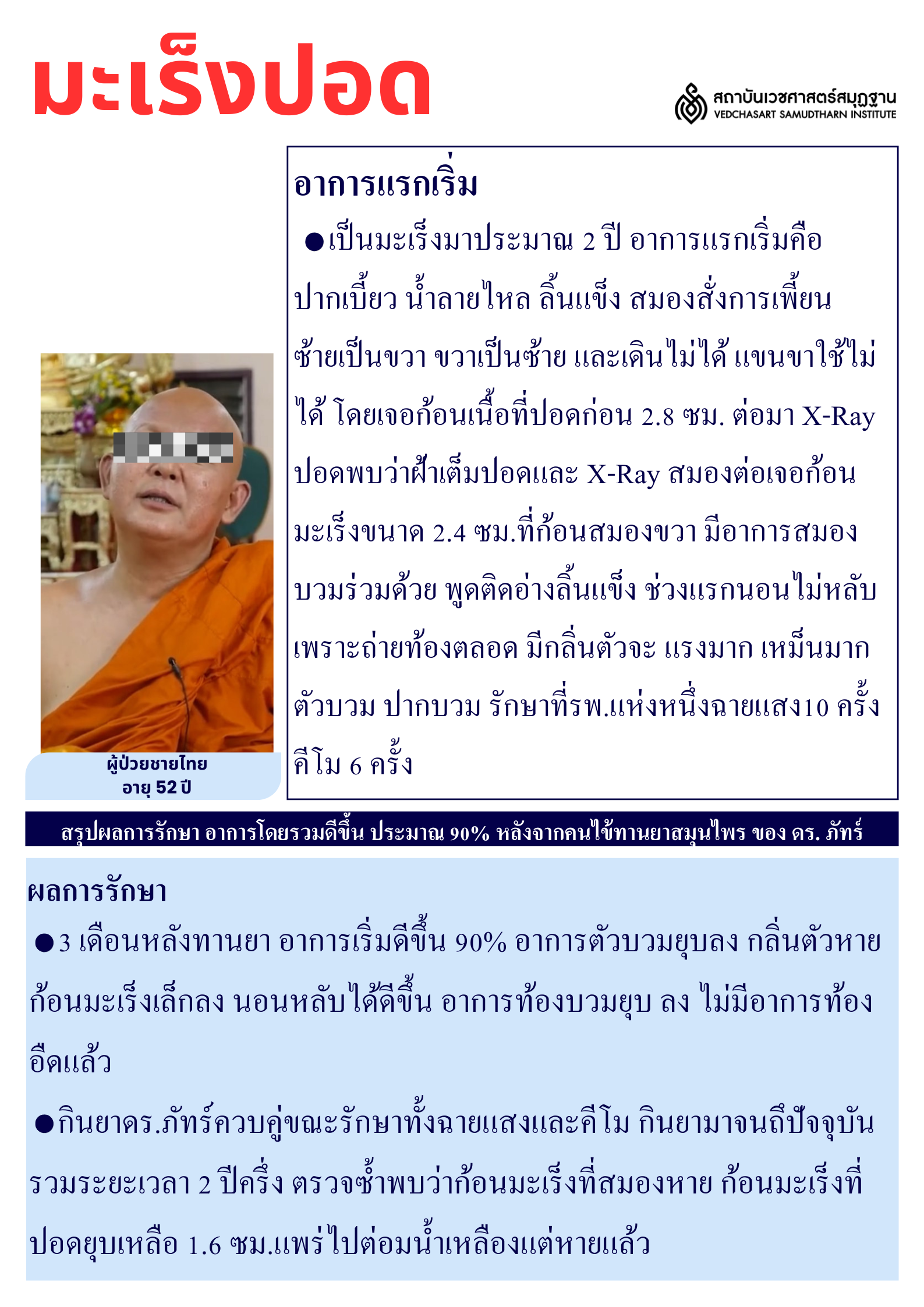 มะเร็งปอด