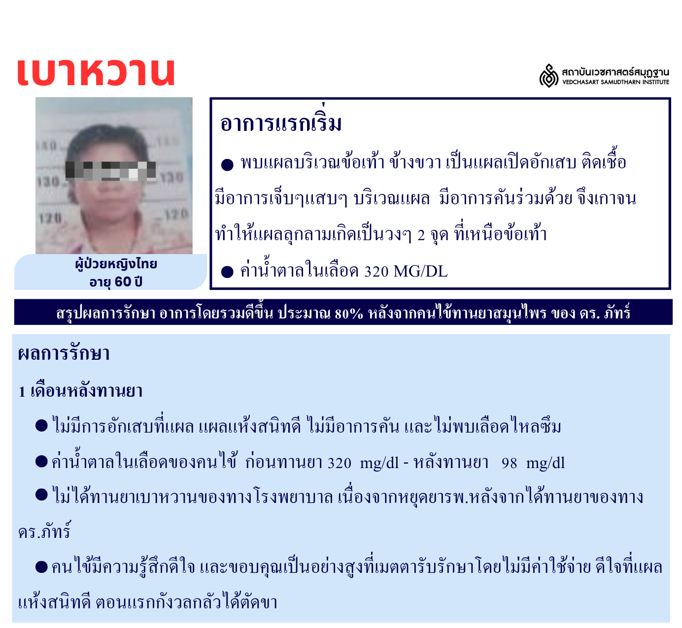 โรคเบาหวาน Diabetes