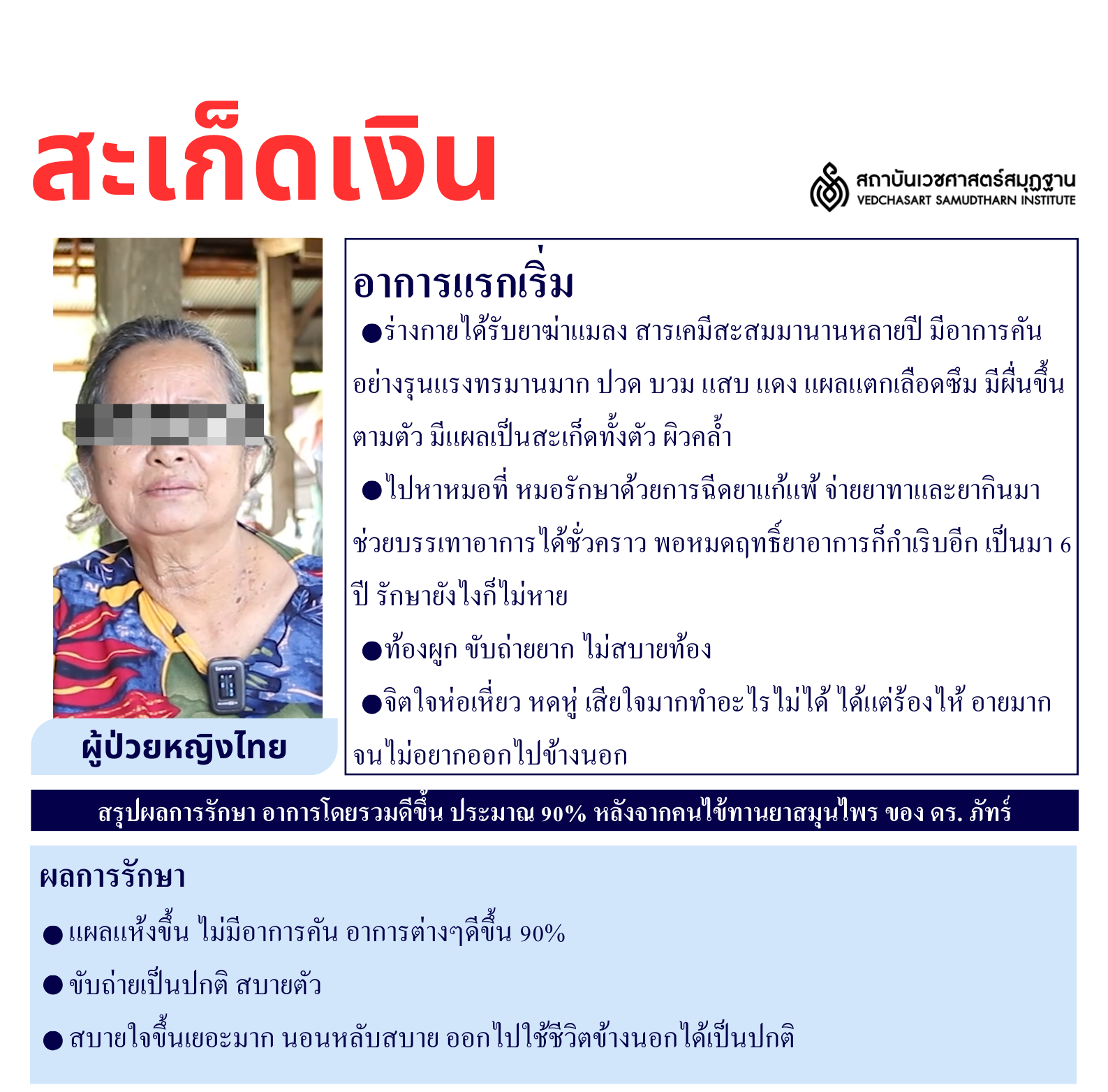 โรคผิวหนัง Skin Disease