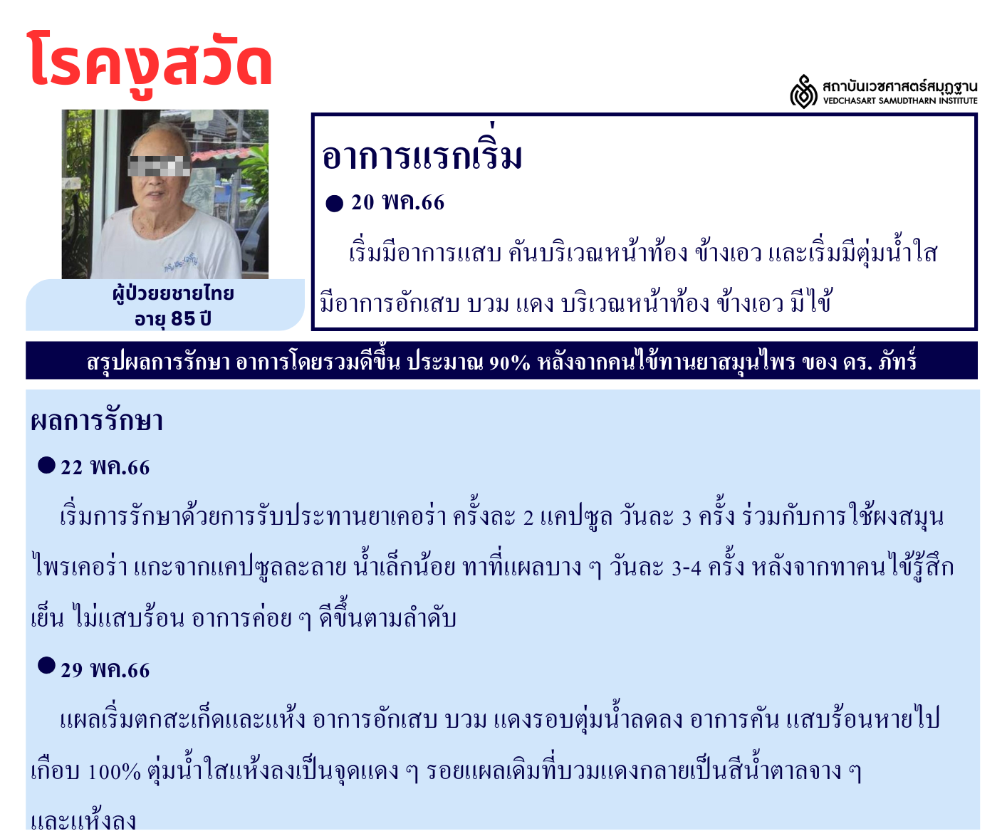 โรคผิวหนัง Skin Disease