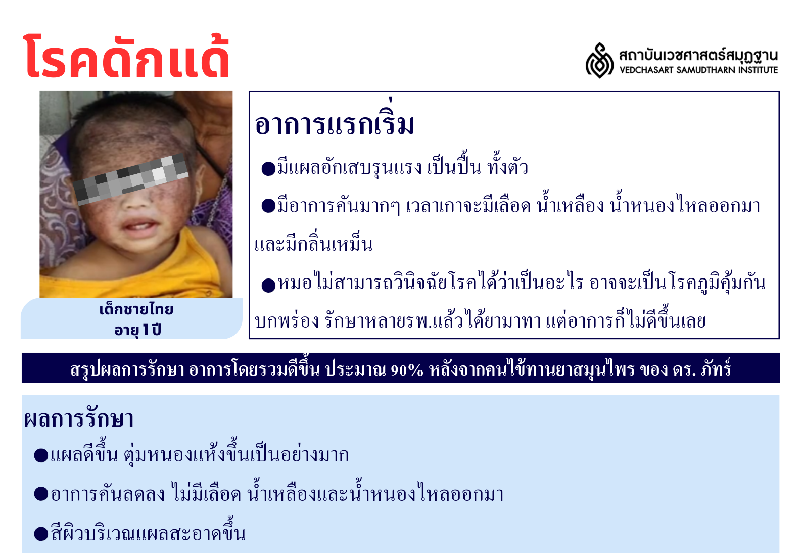 โรคผิวหนัง Skin Disease